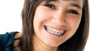 dental-braces Dental Braces - Farmington Hills