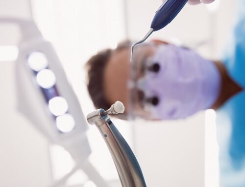 4 Stages of a Root Canal Treatment