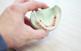 Dental Bridges Can Help with Your Smile Makeover