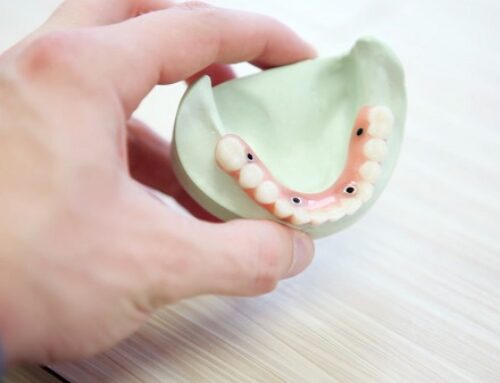 Dental Bridges Can Help with Your Smile Makeover!
