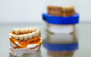 The Importance Of Quality Dental Crowns