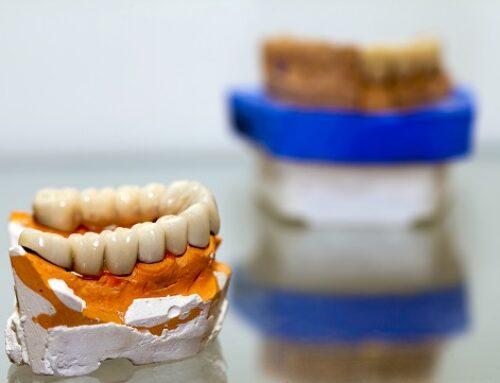 The Importance Of Quality Dental Crowns