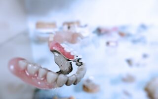 How Long Do Dental Veneers Last