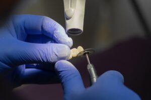 Dental Implants Farmington Hills