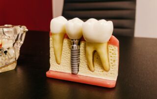Dental Crown vs Implant: Which Option Is Right for You