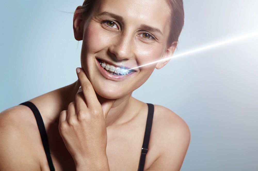 Teeth whitening strips