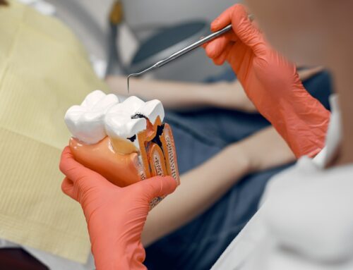 Success in Treating Teeth with Multiple Root Canals: A Closer Look
